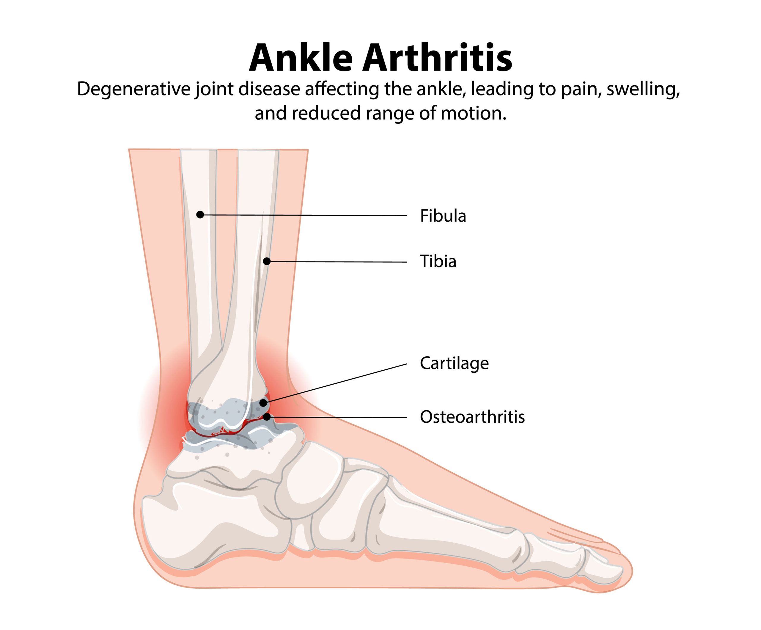 Causes, Symptoms and Diagnosis