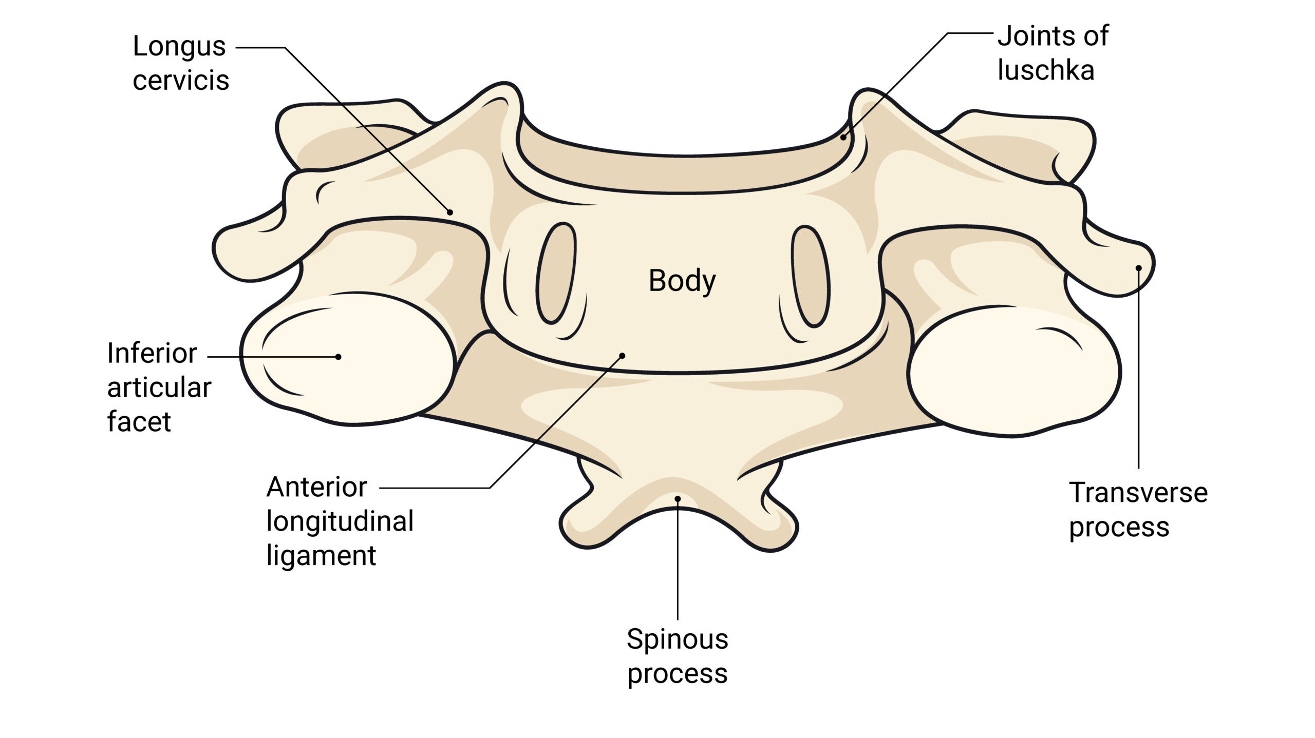 Cervical Stenosis